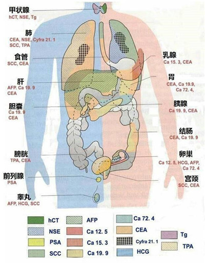 如何看懂肿瘤标志物 哪些人需定期筛查