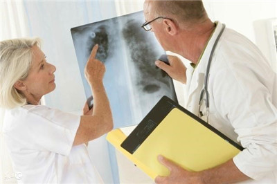 年轻女性肺癌发病超男性，需要警惕什么？