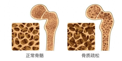 医生解析运动减肥：除了模式，还有时长，到底有多少坑需要绕？